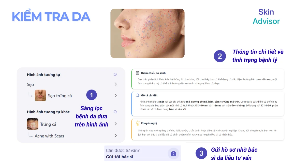 SkinAdvisor AI screenshot